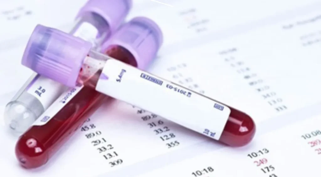 Check-up cardiovascular completo